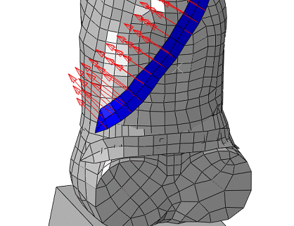 Seat-belt-analysis-of-a-simplified-crash-dummy